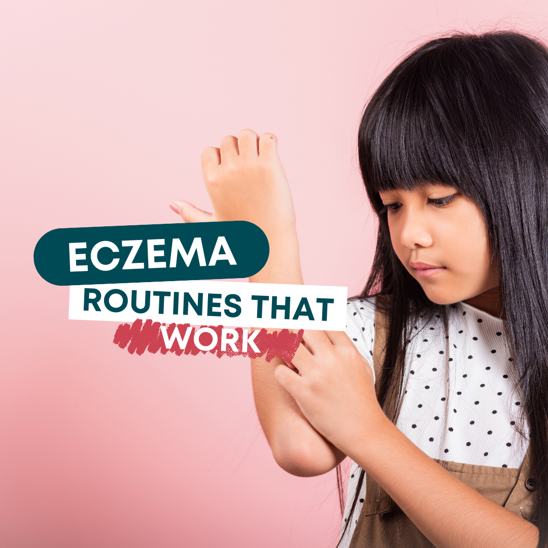 Best Eczema Creams for Babies and Kids
